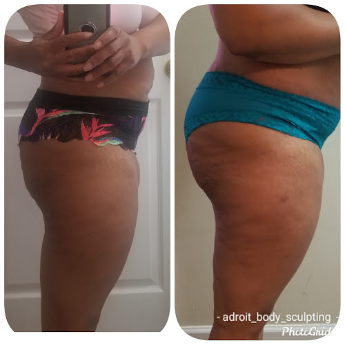 Adroit Body Sculpting clinic