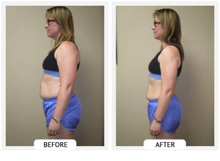 Ballantyne Weight Loss Center clinic