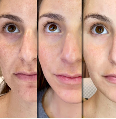 Collagen Bar NYC Microneedling and Body Contouring clinic