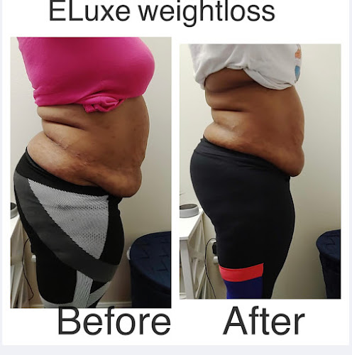Eluxe Weightloss & Aesthetics clinic