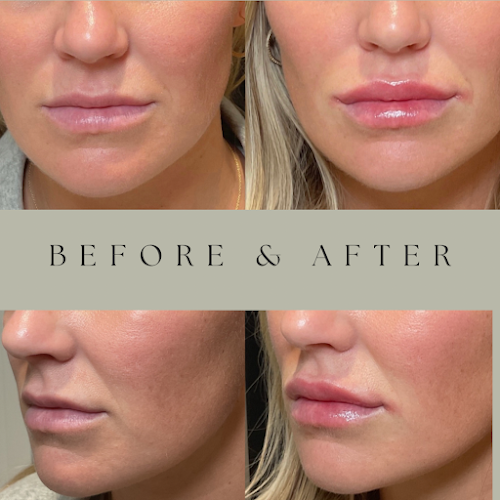 Louisville Aesthetics clinic