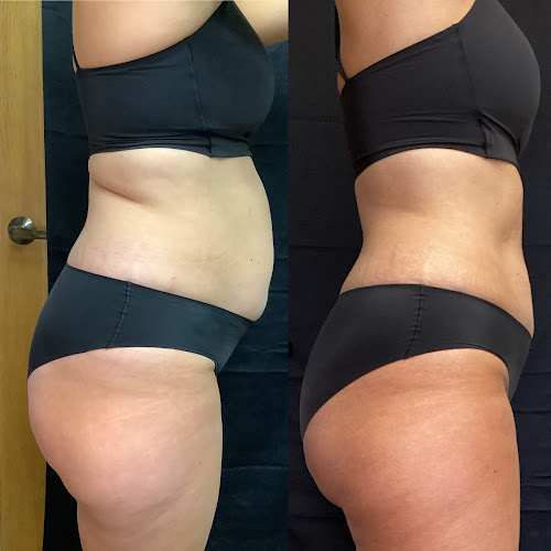 ME Wellness Care & Aesthetics | Emsuite | Weight Loss in Lincoln clinic