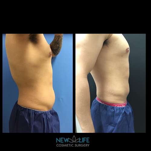 New Life Cosmetic Surgery and Wellness Center clinic