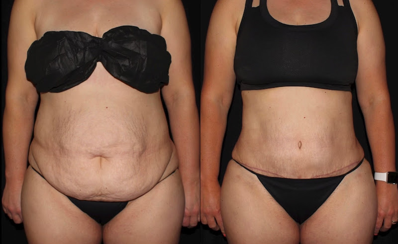 Silk Touch Cosmetic Surgery, Lipo, & Medspa clinic